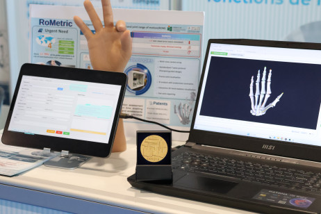 金獎：RoMetric：智能手功能關節活動度評估系統